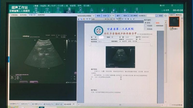 医院慢病管理科室必备设备清单及关键参数揭秘